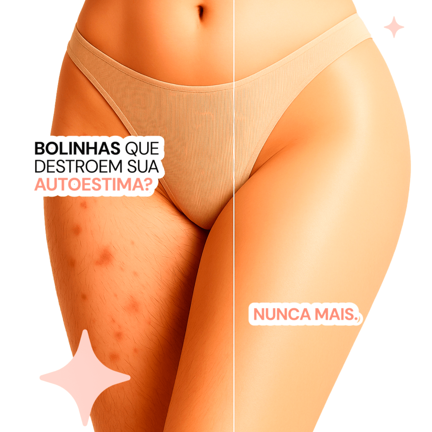 2 Depiladores Anti Foliculite Nanda Intimus